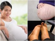Bà bầu - 5 bộ phận trên cơ thể mẹ bầu 3 tháng cuối phải chăm sóc đặc biệt để đẻ xong vẫn đẹp như ngày con gái