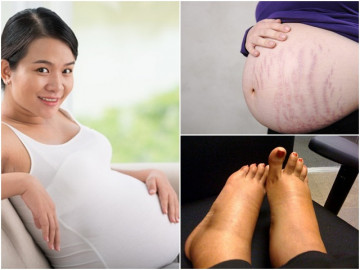 5 bộ phận trên cơ thể mẹ bầu 3 tháng cuối phải chăm sóc đặc biệt để đẻ xong vẫn đẹp như ngày con gái