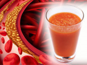 Sức khỏe - Bác sĩ chỉ cách làm cốc nước ép "quét sạch" bẩn trong mạch máu, giúp nhiều người tránh căn bệnh chết nhanh hơn ung thư