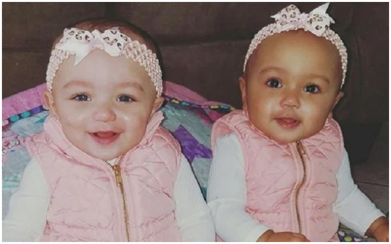 Hai chị em Kalani và Jarani Dean là cặp song sinh đặc biệt khi họ sở hữu hai làn da khác nhau.
