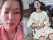 Sức khỏe - Cô gái trẻ ở Đồng Nai mù mắt khi đi làm đẹp, bác sĩ cảnh báo nhiều biến chứng còn đáng sợ hơn nhiều