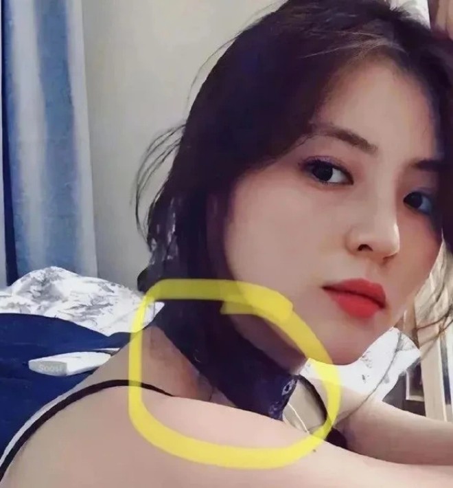 Han So Hee thực sự bị bạo hành?