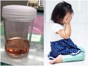 Sức khỏe - Bé gái 7 tuổi đi vệ sinh ra máu vì mẹ thường xuyên cho ăn thứ này để tăng chiều cao
