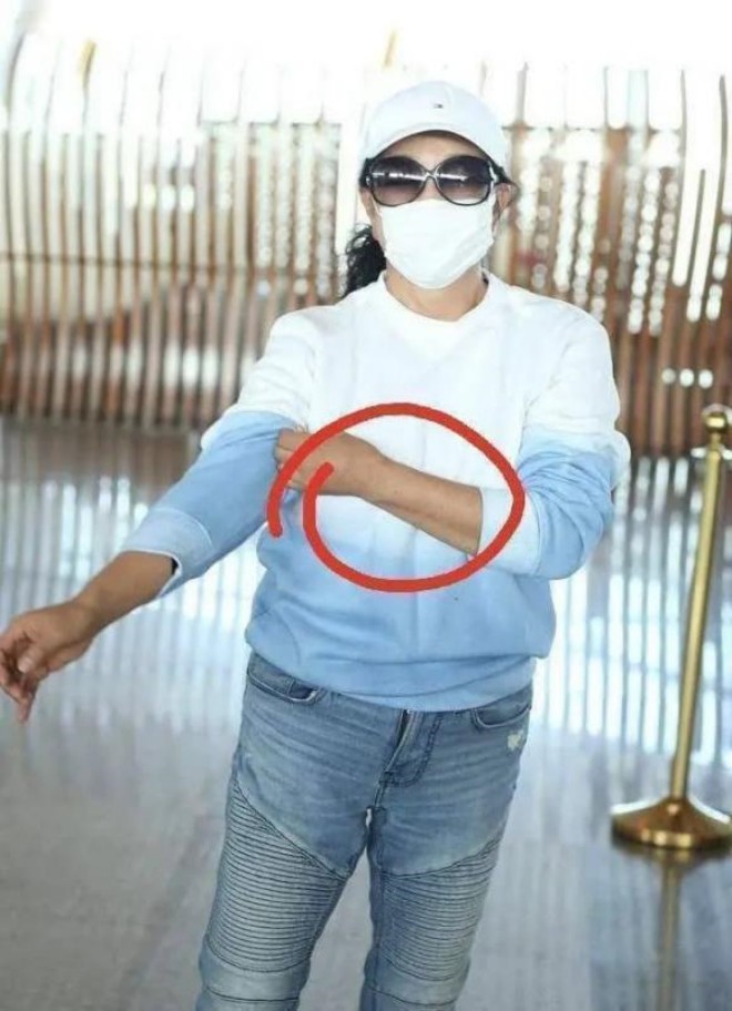 Da tay của bà cũng có dấu hiệu chảy xệ và có nhiều vết đồi mồi.