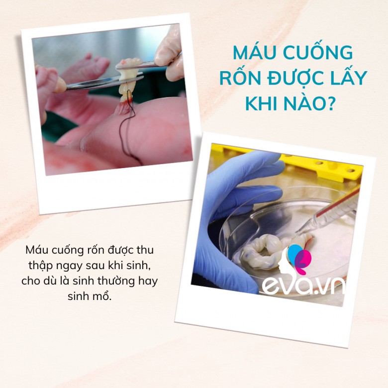 Lý do cha mẹ nên lưu trữ máu cuống rốn cho con mình như một hình thức “bảo hiểm sinh học trọn đời” - 4