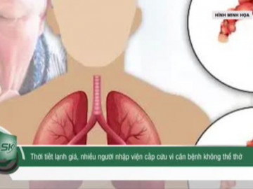 Thời tiết lạnh giá, nhiều người nhập viện cấp cứu vì căn bệnh không thể thở
