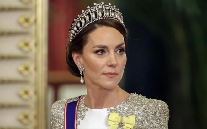 Kate vừa trải qua ca phẫu thuật nhưng kín tiếng không chia sẻ bệnh tình.