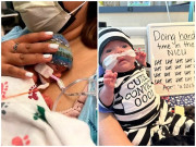 Bà bầu - Em bé chào đời chỉ nặng 410 gram giờ có cuộc sống ra sao