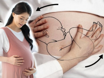 Ngôi thai ngang: Cực hiếm xuất hiện nhưng lại phức tạp và nguy hiểm cho thai nhi