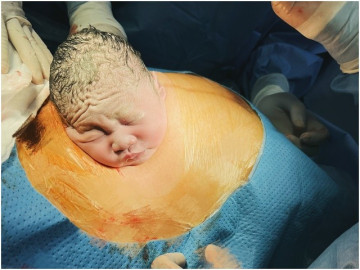 Những cặp vợ chồng nhiều lần chuyển phôi thất bại ở nước ngoài, về Việt Nam làm IVF đã bất ngờ đón trái ngọt