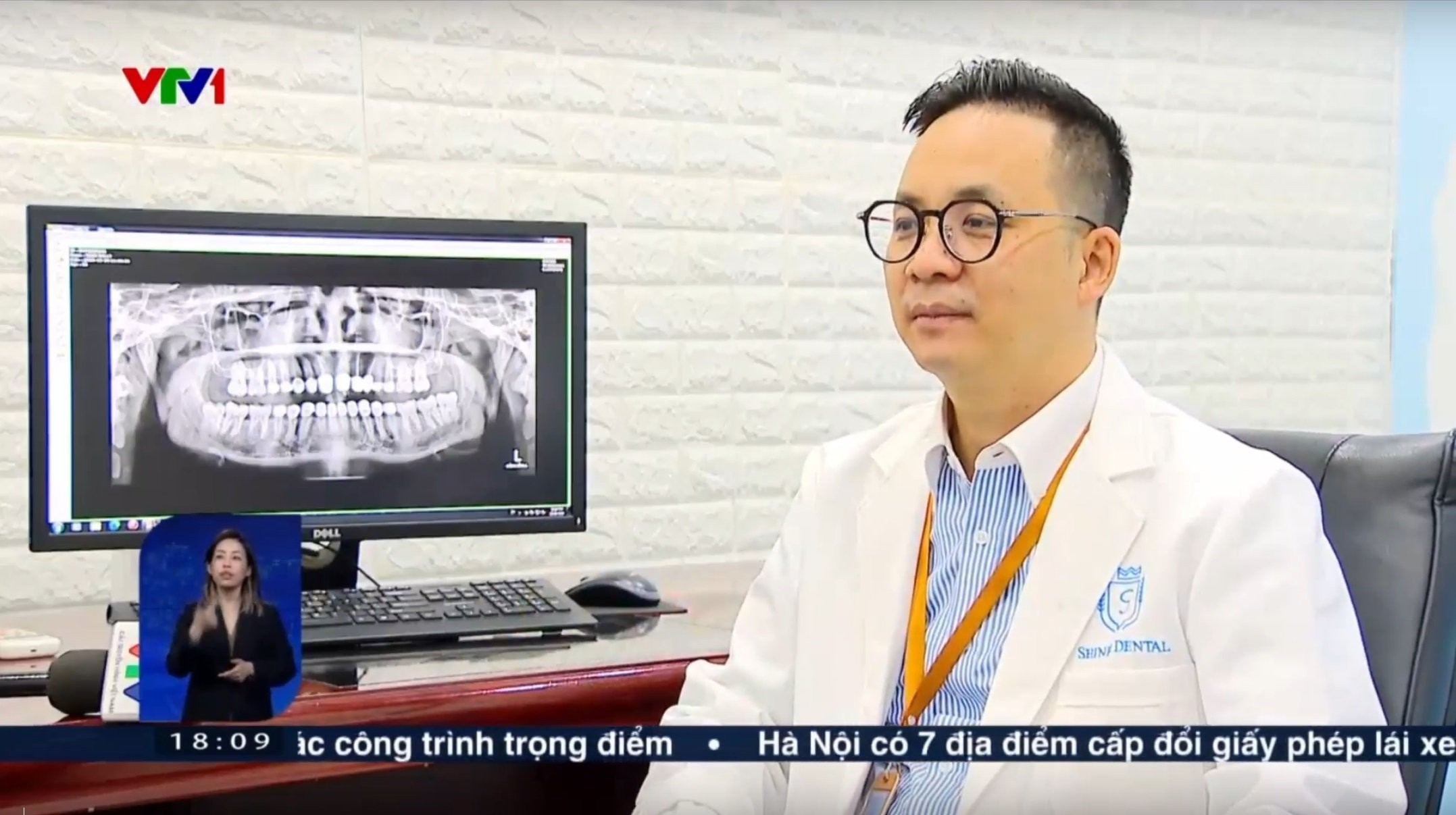 Bác sĩ Nguyễn Văn Hoà - Giám đốc chuyên môn hệ thống a hrefhttps://shinbi.vn/ target_blankNha khoa Shinbi/a cho biết đã phải xử lý nhiều trường hợp liên quan tới răng sứ thẩm mỹ