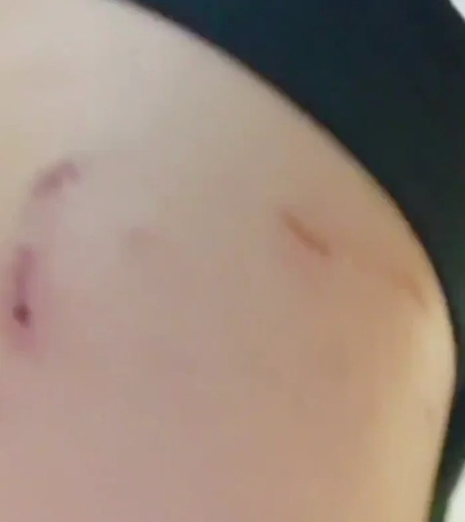 Anh khẳng định vợ chính là người gây ra thương tích cho cô.