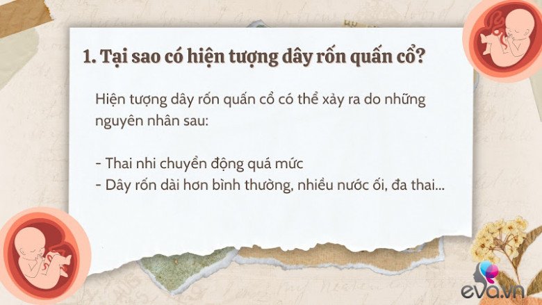 Giải đáp 10 thắc mắc về dây rốn quấn cổ khi mang thai của hầu hết mẹ bầu - 2