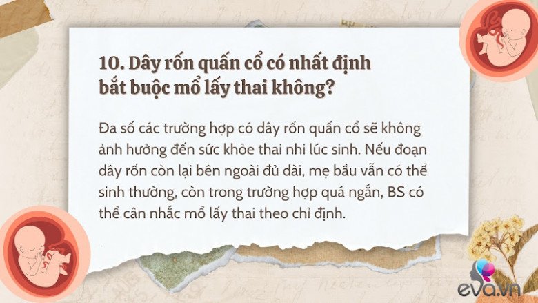 Giải đáp 10 thắc mắc về dây rốn quấn cổ khi mang thai của hầu hết mẹ bầu - 11