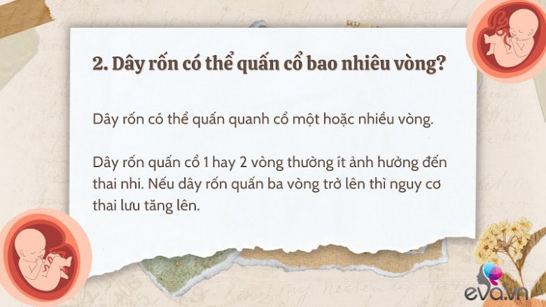 Giải đáp 10 thắc mắc về dây rốn quấn cổ khi mang thai của hầu hết mẹ bầu - 3