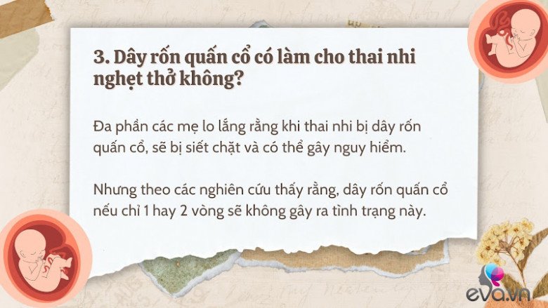 Giải đáp 10 thắc mắc về dây rốn quấn cổ khi mang thai của hầu hết mẹ bầu - 4