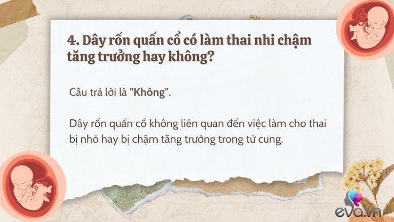 Giải đáp 10 thắc mắc về dây rốn quấn cổ khi mang thai của hầu hết mẹ bầu - 5