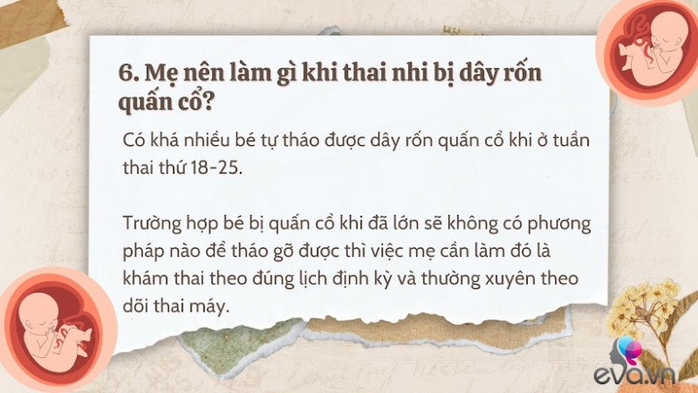 Giải đáp 10 thắc mắc về dây rốn quấn cổ khi mang thai của hầu hết mẹ bầu - 7