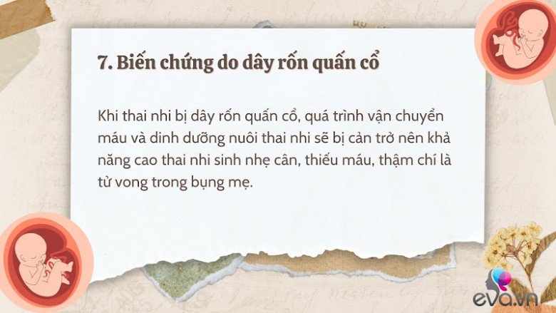 Giải đáp 10 thắc mắc về dây rốn quấn cổ khi mang thai của hầu hết mẹ bầu - 8