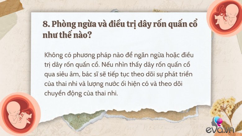 Giải đáp 10 thắc mắc về dây rốn quấn cổ khi mang thai của hầu hết mẹ bầu - 9