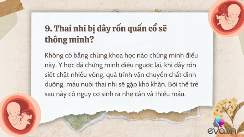 Giải đáp 10 thắc mắc về dây rốn quấn cổ khi mang thai của hầu hết mẹ bầu - 10