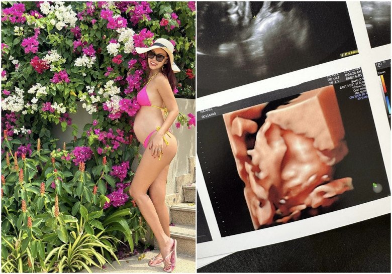 Sao Việt 24h: Đàm Vĩnh Hưng bất ngờ trượt ngã gặp tai nạn nặng, tình cảnh hiện tại khiến khán giả xót xa - 11