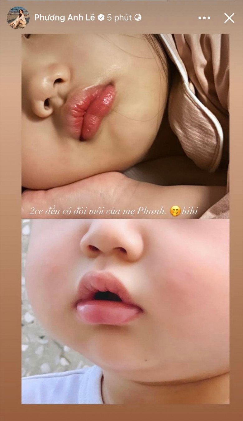 Sao Việt 24h: Đàm Vĩnh Hưng bất ngờ trượt ngã gặp tai nạn nặng, tình cảnh hiện tại khiến khán giả xót xa - 4