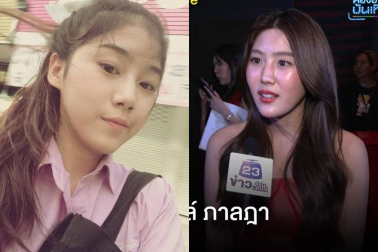 Soraya Titawasira gây chấn động truyền thông với nhan sắc trước và sau khi gặp tai nạn dao kéo.