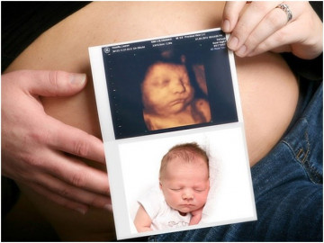 8 yếu tố ảnh hưởng đến cân nặng thai nhi, mẹ bầu nào cũng phải biết để con phát triển ổn định 