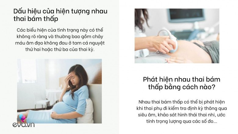 Nhau thai bám thấp: Tình trạng mẹ bầu nào cũng sợ và các nguy hiểm cần biết - 3