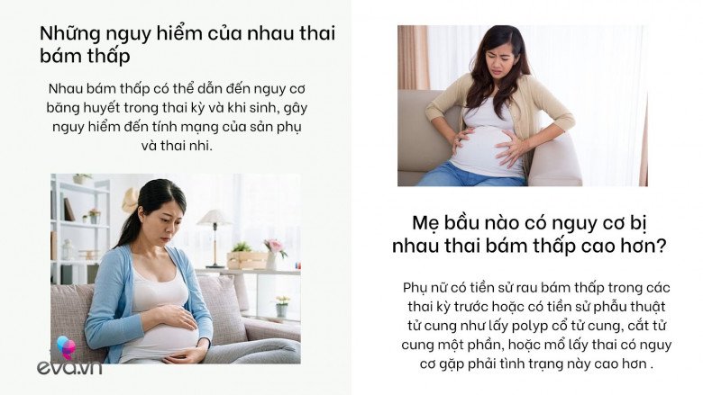 Nhau thai bám thấp: Tình trạng mẹ bầu nào cũng sợ và các nguy hiểm cần biết - 4