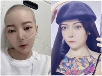 Hotgirl 28 tuổi qua đời vì ung thư thận, trước khi mất nhắn nhủ mọi người đừng làm 2 việc