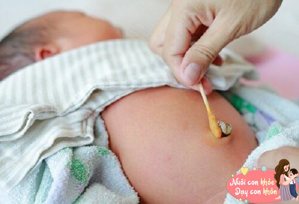 Bố mẹ nên kiểm tra kỹ lưỡng dây rốn, đảm bảo khô ráo và không có dấu hiệu viêm nhiễm.