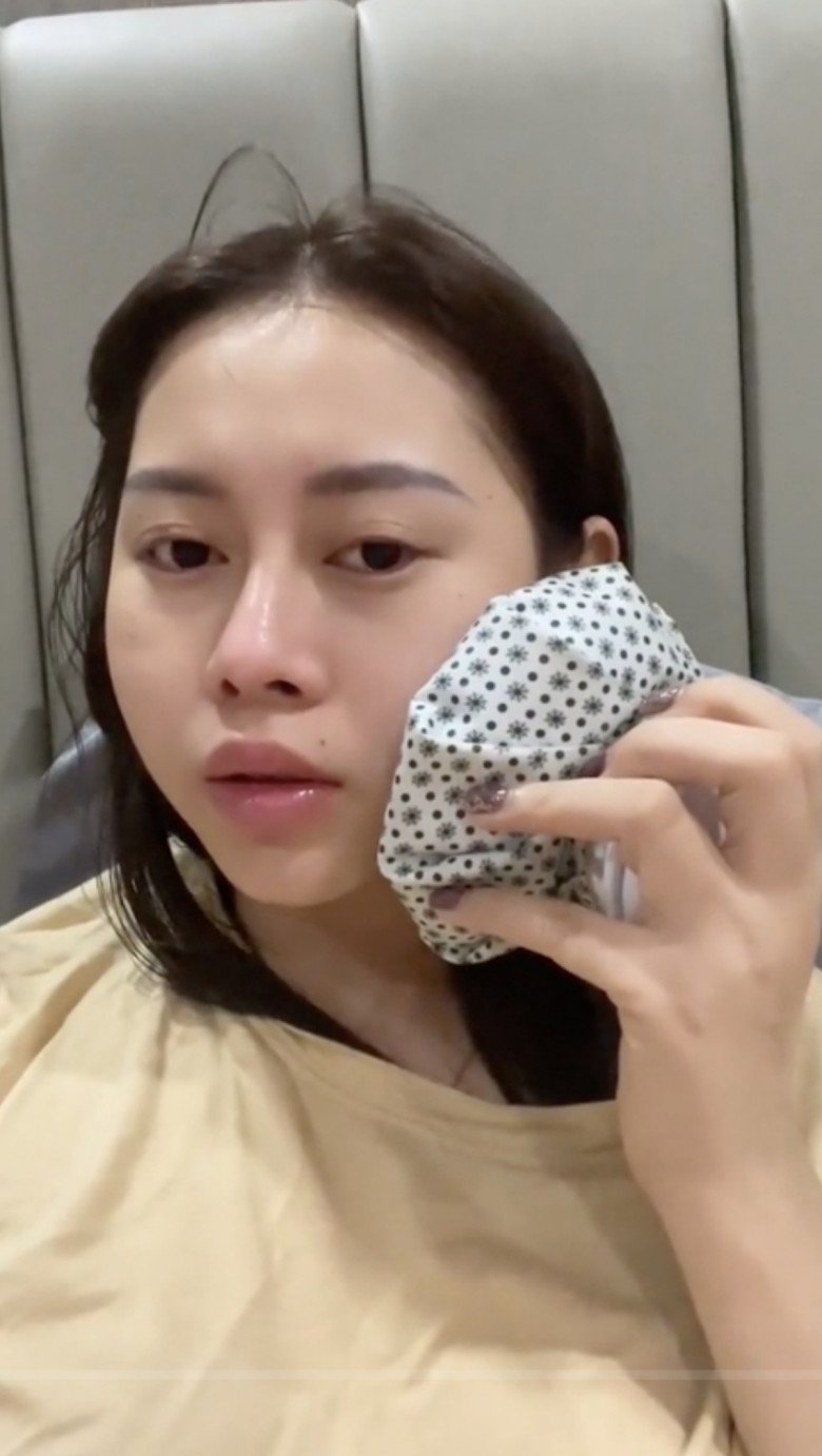 Người đẹp cật lực đi khám và được kê thuốc để uống, kết hợp chườm lạnh thì phần má cũng có chuyển biến nhẹ là xẹp đi. Tuy nhiên, phần sưng nề sau đó vẫn tiếp tục xảy ra khi hết thuốc.