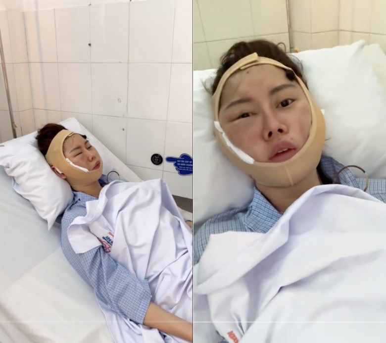 Từng trải qua tai nạn biến chứng vì thẩm mỹ nhưng theo Phương Thoa, đây là lần kinh khủng nhất với cô. Hot Tiktoker đã can đảm quay video lại để cảnh tỉnh mọi người rút kinh nghiệm trước khi đưa ra quyết định làm đẹp.