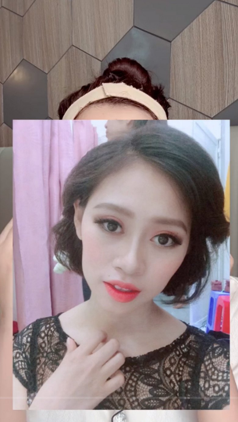 Chuyện xảy ra vào 2017, lúc này cô nàng tự ti về chiếc má hóp và chiếc cằm chẻ. Gương mặt khiến cô gặp nhiều hạn chế trong chuyện công việc nên đã có ý định muốn tút tát.