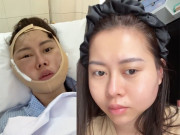 Làm đẹp - Gần 15 triệu lượt nghe "chị Google" kể bị lừa tiêm silicon vào mặt, bác sĩ lên tiếng cảnh báo