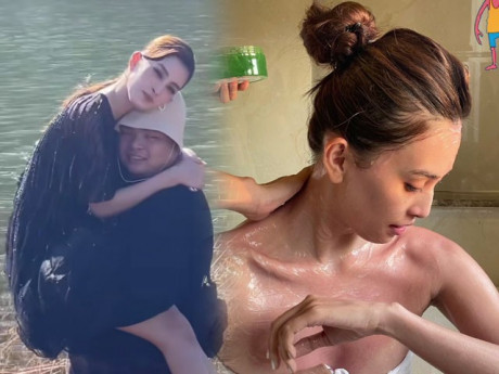 "Hoa hậu ngàn năm có một" lộ da đỏ như tôm luộc: Có ba lưu ý chị em phải nắm để chăm da hè này