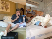 Giải trí - Ca sĩ Đàm Vĩnh Hưng phải chi 20 tỉ đồng chữa chân gãy nếu điều trị tại Mỹ