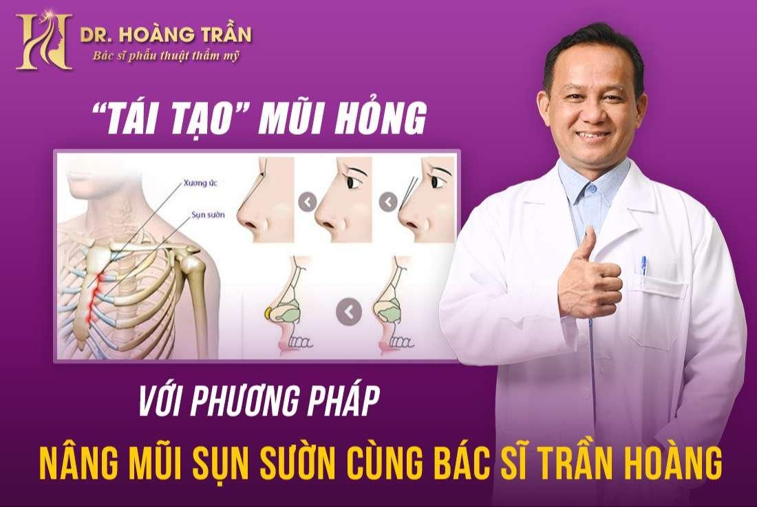 “Tái tạo” mũi hỏng với phương pháp nâng mũi sụn sườn cùng bác sĩ Trần Hoàng - 1