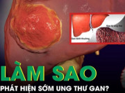 Clip Eva - Thuốc, thực phẩm chức năng giảm cân: Lợi hay hại?