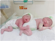 Bà bầu - Mẹ bầu song thai trong đó 1 bé thụ thai tự nhiên, 1 bé IVF nhờ vợ chồng gần nhau ngay đêm trước chuyển phôi