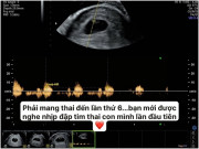 Bà bầu - 5 lần mang thai đều thất vọng vì túi thai trống, mẹ bầu bật khóc trên bàn siêu âm khi nghe tiếng tim thai