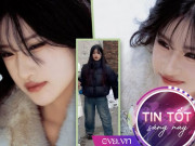 Tin tức - Cô gái 22 tuổi không dám yêu ai vì khuyết tật chân, đổi đời sau bộ ảnh "vịt hóa thiên nga"