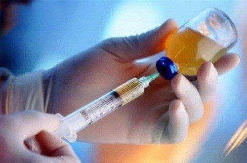 Silicon là chất làm đầy không được Bộ Y tế cấp phép sử dụng. Ảnh minh họa. 