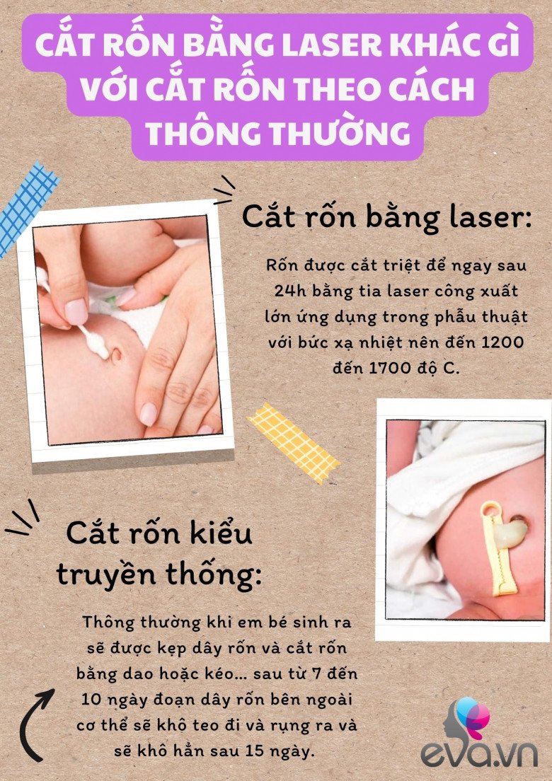 amp;#34;Cắt rốn bằng laser có lợi cho trẻ thế nàoamp;#34; và những điều mẹ bầu cần biết về phương pháp hiện đại này - 2