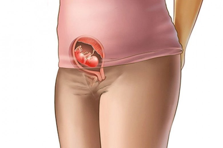 Giai đoạn đầu khi mang thai rất nguy hiểm nếu mẹ bầu không cẩn trọng. (Ảnh minh họa)