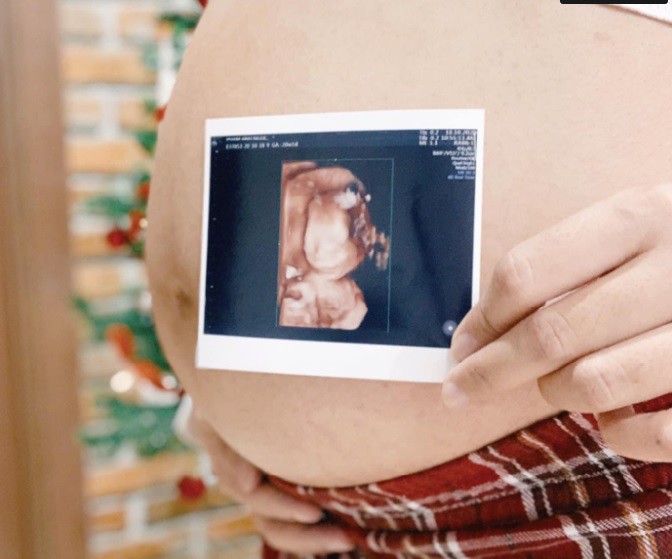 Quan hệ trong cửa sổ thụ thai là tăng khả năng có thai tự nhiên. Ảnh: Anh Ngọc
