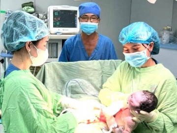 Bình Dương: Cứu thành công 3 rồng vàng hiếm gặp