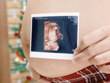 4 việc cần làm để nhanh có thai